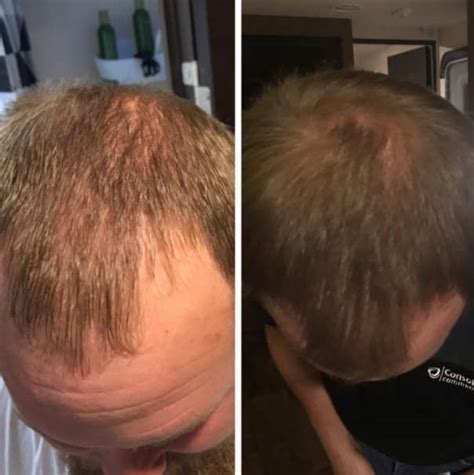 You've likely seen a lot about castor oil for hair growth on the internet, but does it actually work wonders? Thousands Swear By This Castor Oil To Help Their Hair Grow