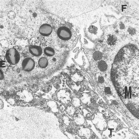 Mast Cell In Contact With Eosinophil Shows Evidence Of Focal Download Scientific Diagram