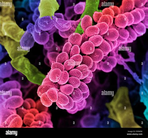 Streptococcus Bacteria Coloured Scanning Electron Micrograph Sem Of