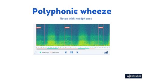 Lung Sounds Polyphonic Wheeze Youtube