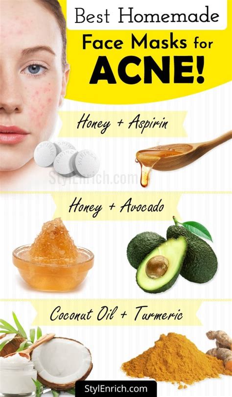 Homemade Face Mask For Acne Treatment At Home