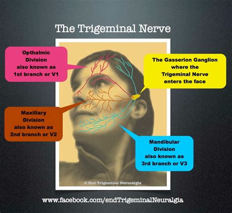 End Trigeminal Neuralgia Treating Trigeminal Neuralgia