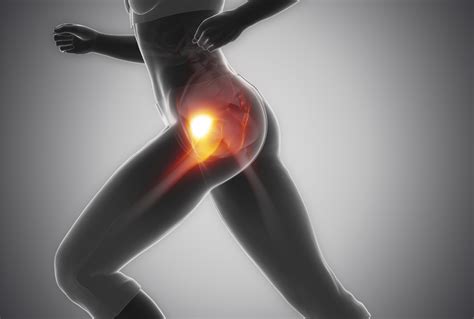 Trapped Nerve In Hip Causes Symptoms And Treatment