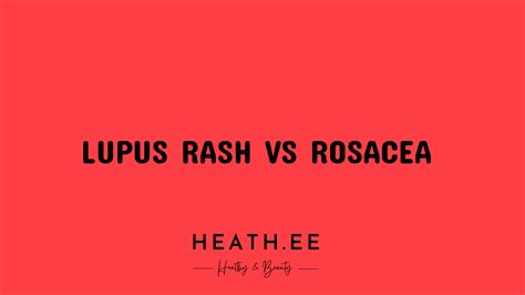 Lupus Rash Vs Rosacea Whats The Difference Heathe