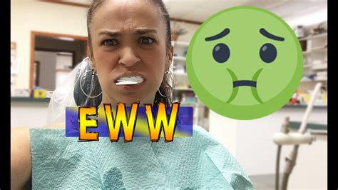 Gross Disgusting Drool At The Dentist Crown Making Youtube
