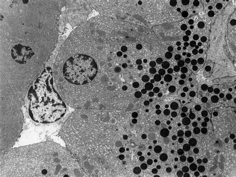 Pancreatic Acinar Cells Em