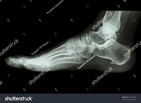 Xray Normal Humans Foot Lateral Stock Photo 190283855