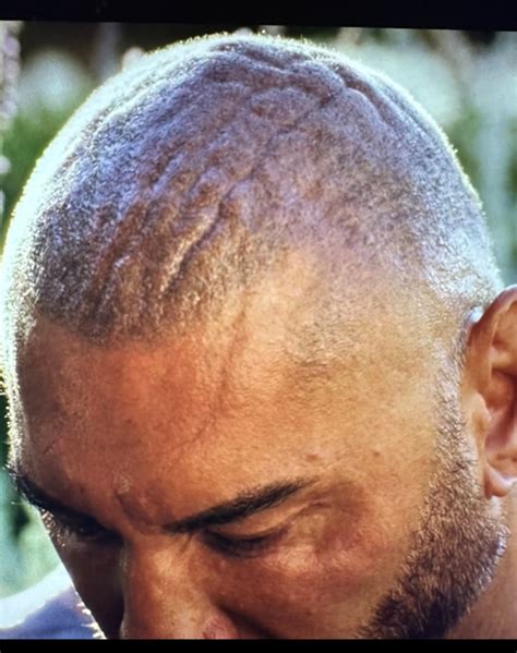 Why Is Dave Bautistas Head So Wrinkly Reason Dave Bautista Glass