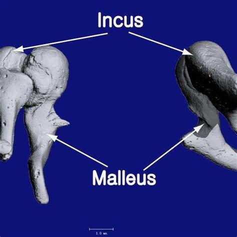 Three Dimensional Volume Reconstruction Of The Malleus And Incus Bones