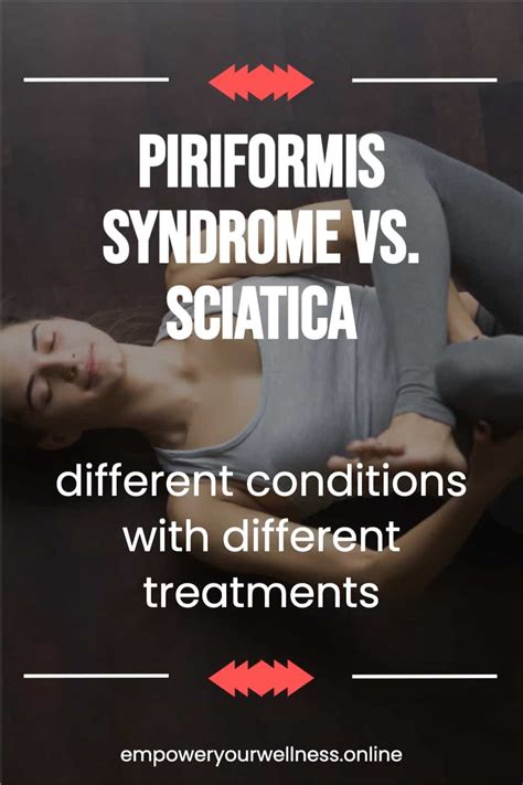 Piriformis Syndrome Vs Sciatica Key Differences EMPOWER YOURWELLNESS
