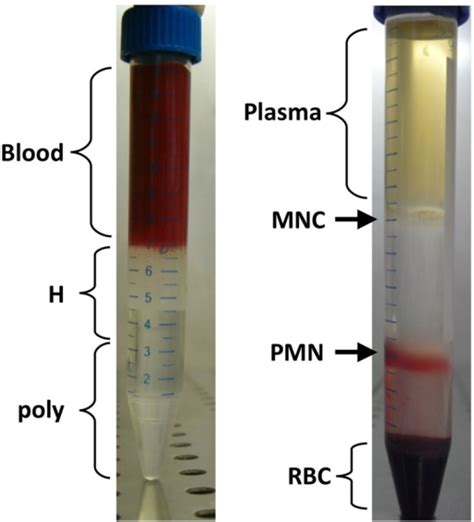 Human quantikine elisa kits were purchased from r&d system (usa). ficoll_Paque Phamacia_Paque Plus_Hypaque - www.qiqiapk.com