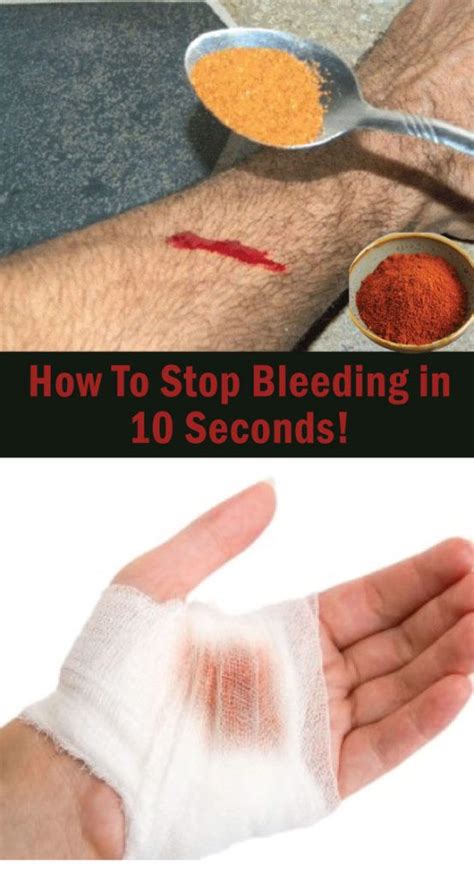How To Stop Bleeding In 10 Seconds Cold Prevention Healthy Healthy