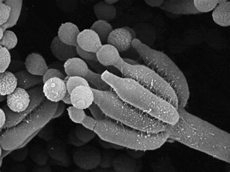 Penicillium Microscope Hot Sex Picture