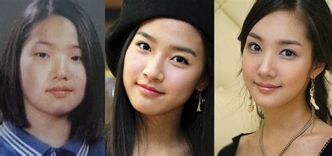 Park Min Young Plastic Surgery Before And After Pictures 2023