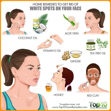 Home Remedies To Get Rid Of White Spots On Your Face How To Do