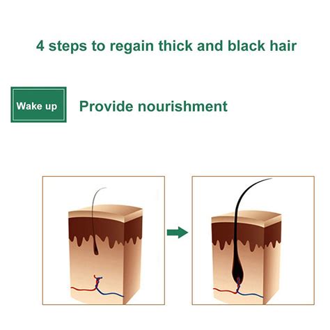 Effectively combats hair loss — made start counting the days and see significant results with continuous use! 7Days Hair Regrowth Serum - Not sold in stores