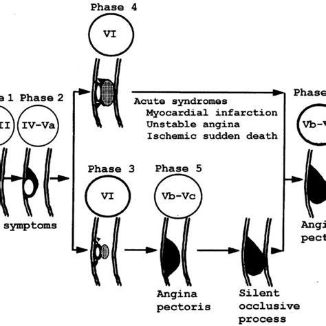 Schematic Representation Of Staging Phases And Lesion Morphology Of