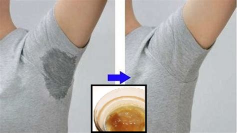 Get Rid Of Excessive Armpit Sweating Naturally And Quickly