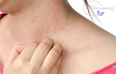 Skin Rash Description Of The Elements Of The Rash Types And Treatment