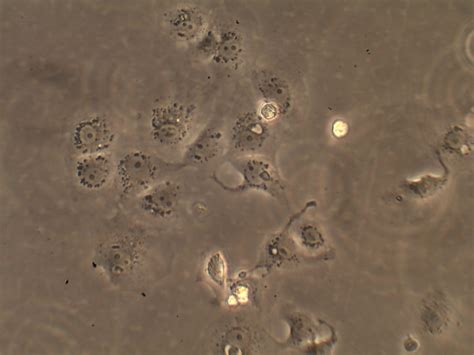 The lineage was developed on 27 march 1962, by yasumura and kawakita at the chiba university in chiba, japan. What could be causing cytoplasmic granules in VERO cells ...