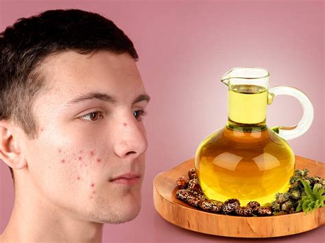 Take half teaspoon of each castor oil, lemon juice and glycerin. Castor oil for acne: How does castor oil help to get rid ...