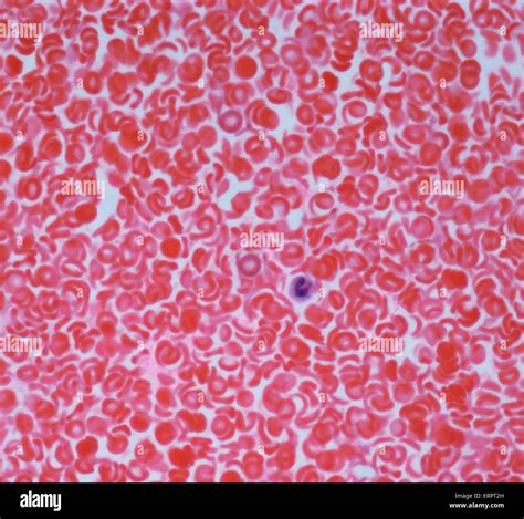 Red Blood Cell Microscope Slide