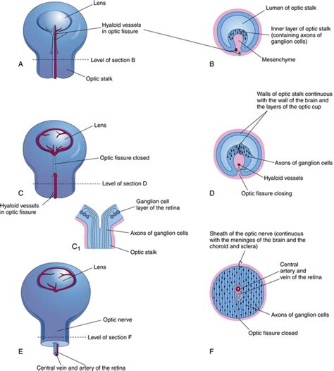 Ocular Embryology Clinical Gate