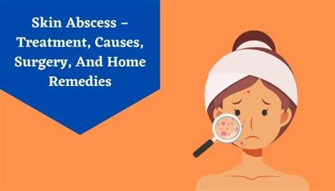 Skin Abscess An Overview Of Skin Abscess Its Causes Treatment