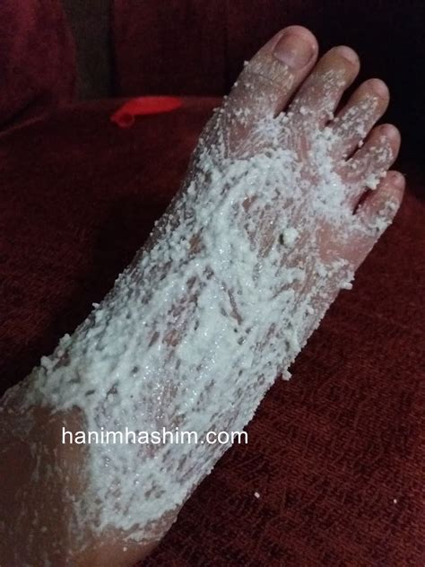 Maybe you would like to learn more about one of these? Petua Melegakan Bengkak Akibat Gigitan Serangga - Nukilan ...