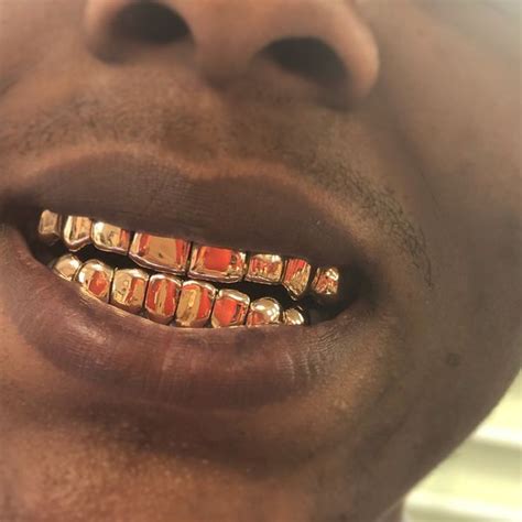 About gold. an introspective debut ep by memphian rapper, goldperms, exploring depression, family, and his mind. Perm look gold Teeth for Sale in Miami Gardens, FL ...