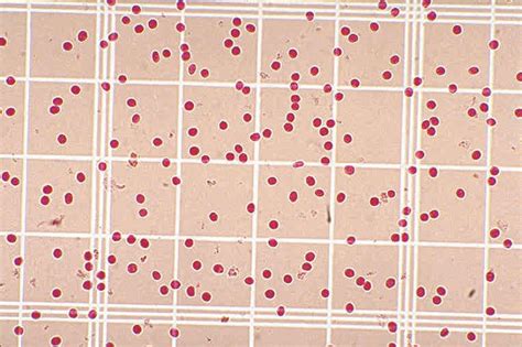 470023 666ea Description Simulated Red Blood Cell Counts With A