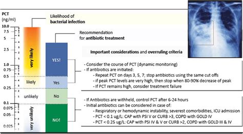 Procalcitonin Pct Algorithm In Patients With Respiratory Tract