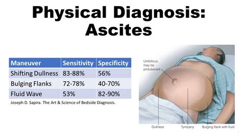 Ascites Physical Exam Diagnostic Accuracy Sensitivity Grepmed