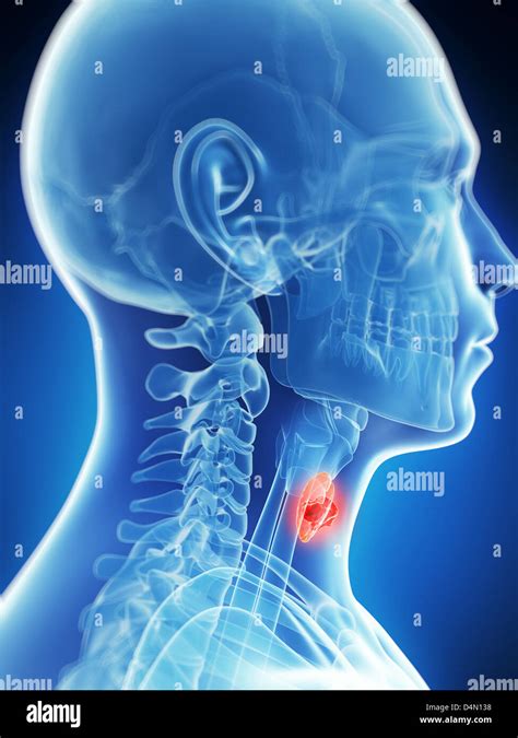 Thyroid Gland Cancer Stock Photo Alamy