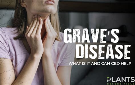 Graves Disease What Is It And Can Cbd Help Plants Before Pills