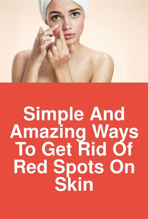 Simple And Amazing Ways To Get Rid Of Red Spots On Skin Red Spots All