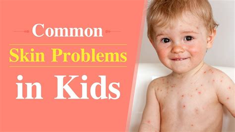 6 Common Skin Problems In Children Youtube