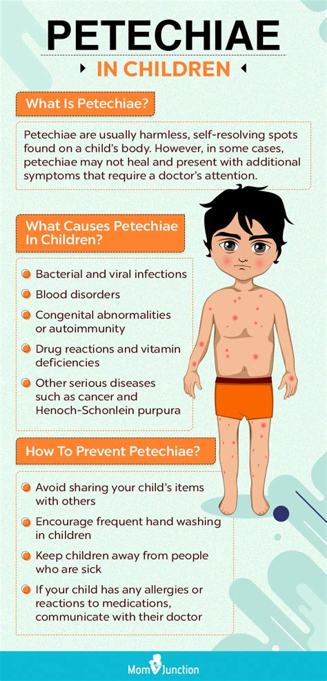 Petechiae In Children Causes Symptoms And When To Worry