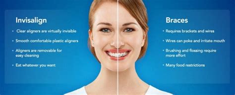 Invisalign Adults In Charlotte Nc Clearsmile Orthodontics