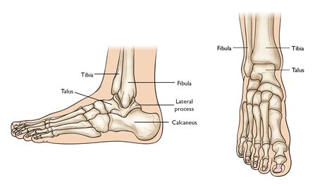 Talus Fractures Orthoinfo Aaos