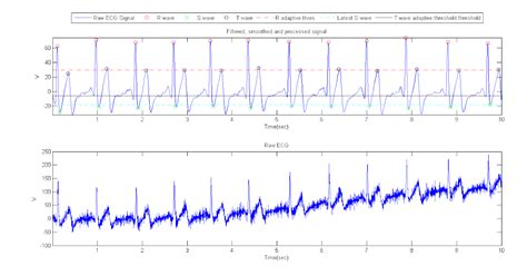 How To Calculate Heart Rate From Ecg Matlab Haiper
