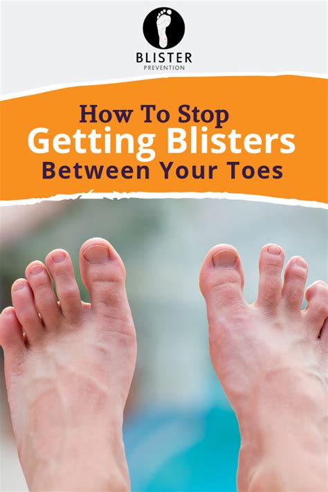 Blisters Between Toes 7 Expert Ways To Prevent Blisters Toes
