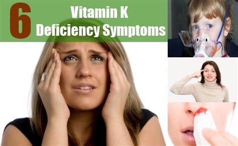 6 Major Vitamin K Deficiency Symptoms Search Home Remedy Part 103