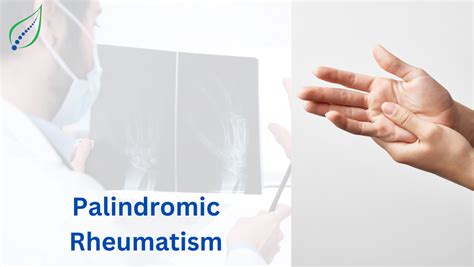 Palindromic Rheumatism Best Back Pain Slip Disc Knee Arthritis