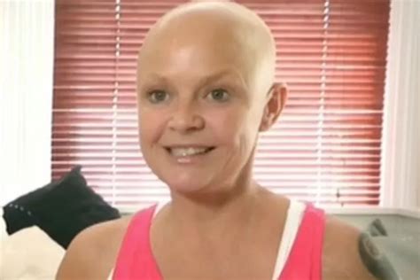 Gail Porter Gets 28jj Breasts Reduced To C Cup After Confessing She Cut Herself Because They