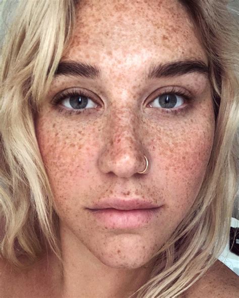Kesha Shows Off Her Freckles In Makeup Free Selfie Rfreckledgirls