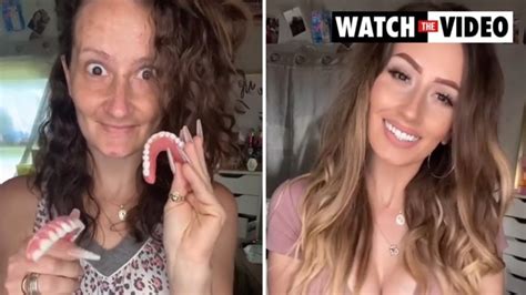 Toothless Mums Jaw Dropping Transformation The Advertiser