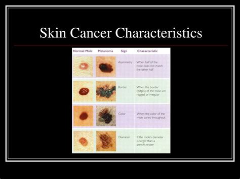 Ppt Skin Cancer Most Common Type Of Cancer Between Men And Women