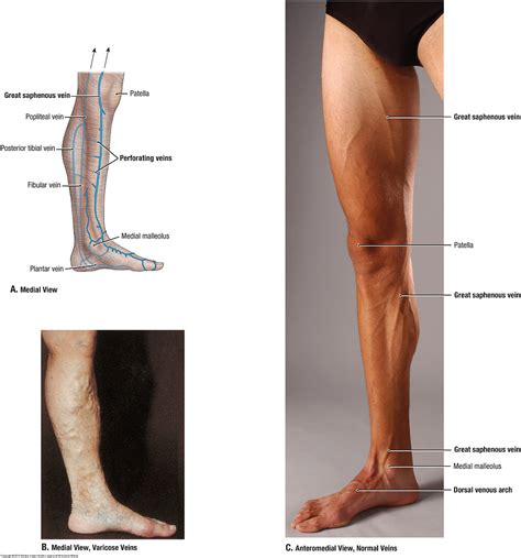 When a muscle is activated it contracts, making itself shorter and thicker, thereby pulling its ends closer. Duke Anatomy - Lab 14: Anterior Thigh & Leg