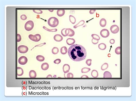 Ppt Hematologia Serie Roja Powerpoint Presentation Free Download